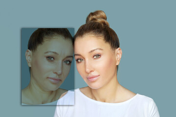 Ageing skin ,internal and external causes of skin aging, signs of skin aging