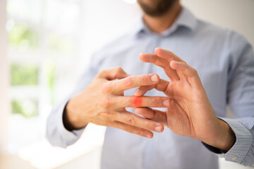 Finger Joint Arthritis. Hand Rheumatism Ache