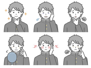 顔の肌に関する色々　男子学生