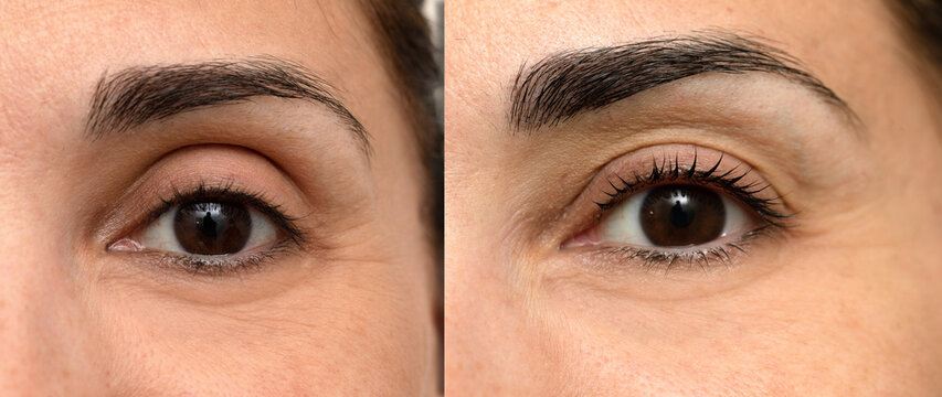Woman eye before and after treatment of eyelash lamination