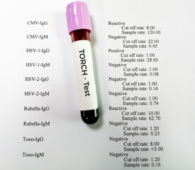 Blood sample for TORCH test, TORCH Panel Test.Toxoplasma, Rubella, Cytomegalovirus, Herpes simplex.