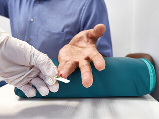 The doctor pierces the finger to collect blood to analyze the sugar content in the body. Diagnosis...
