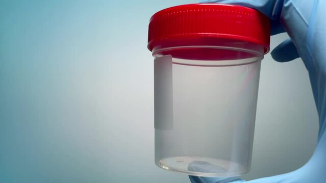 Gloved hand holds biomaterial container on blue medical background. Sterile medical container for taking biomaterials. Stool and urine analysis. Collecting analysis. Chronic prostatitis. Medical test