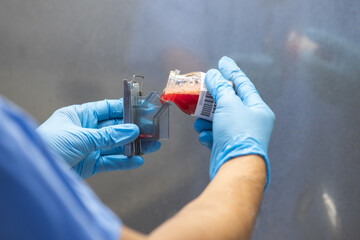 Obraz premium Medical scientists preparing cytology specimens in a hospital laboratory.
