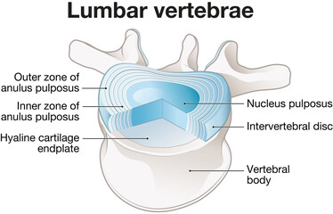 Healthy lumbar vertebrae and intervertebral disc. Labeled illustration