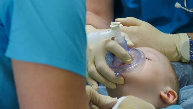 Little child under anaesthesia. Breathing mask on boy face. Health care and life saving. Breathing tube being inserted into mouth of kid. Preparing for surgery. Treatment of multiple caries. Operation