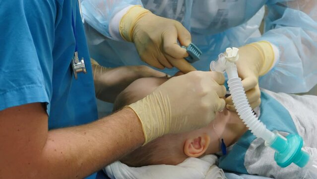 Little child under anaesthesia. Breathing mask on boy face. Health care and life saving. Breathing tube being inserted into mouth of kid. Preparing for surgery. Treatment of multiple caries. Operation
