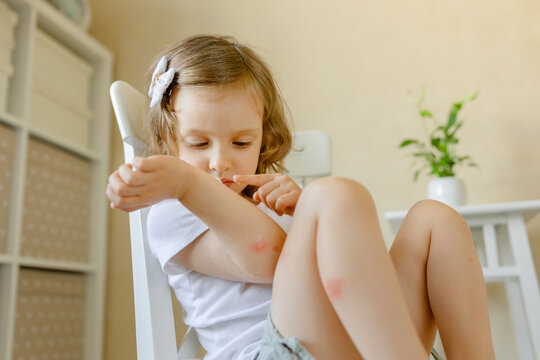 First aid and remedy for allergy to insect bites and for wound healing