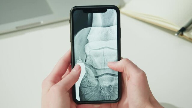 Doctor veterinarian examining horse hoof skeleton roentgen close-up. Woman vet analyzing animal bones x-ray, leg joint on smartphone. Healthcare and medicine concept. 