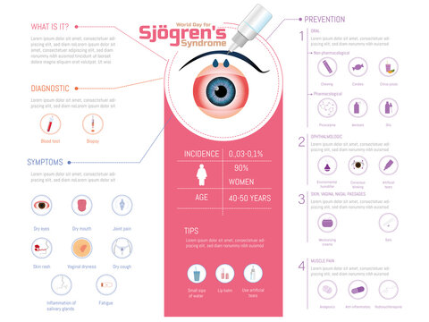 World Sjögren's Syndrome Day, Infographic of eyes with artificial tears falling on them to moisturize on a white background. Icons of symptoms and prevention to take into account .