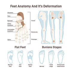Human foot bones. Footstep anatomical structure with captions,