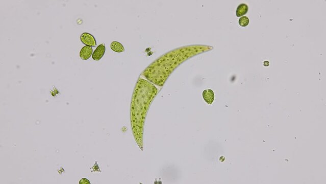 Bacteria and Protozoa in waste water under the microscope.
