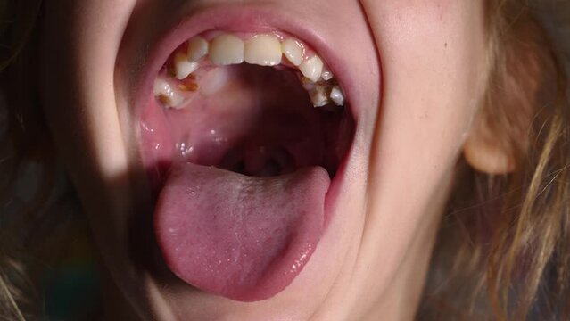 The girl opens her mouth wide and sticks out her long tongue. Child shows her teeth and soft palate. Mouth wide open, tongue stuck out as far as possible. Close-up