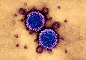 SARS-COV-2 virus variant ba.4 and ba.5 COVID-19 concept for pandemics respiratory disease new...