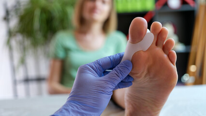 Doctor orthopedist examining leg with hallux valgus deformity of first toe - obrazy, fototapety, plakaty