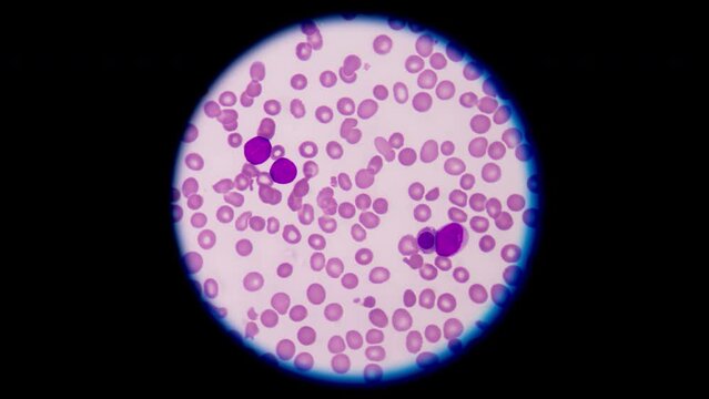 Mixed cells in stop motion footage.