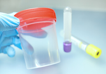 Gloved hand holds sterile container for biomaterials, blood collection tubes. Container for urine...