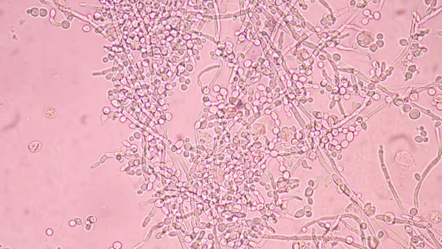 Yeast cells stop motion.