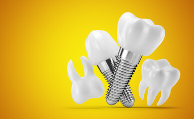 dental implants on a yellow background. 3d rendering, 3d illustration