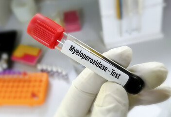 Blood sample for Myeloperoxidase (MPO) test with blurred laboratory background.