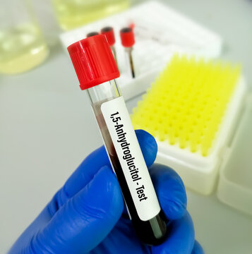 1,5-anhydroglucitol (GlycoMark) test, a marker of short-term glycemic control