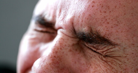 Man squinting eyes close-up face, redhair closeup eye squint