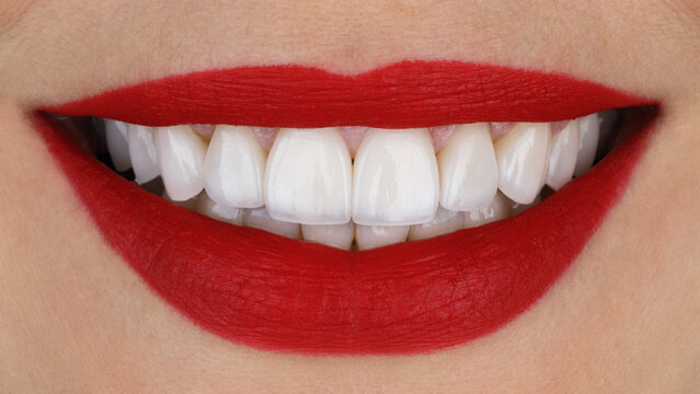 perfect smile of a girl with ceramic veneers and red lips