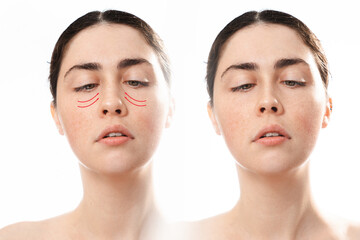 Two face of a caucasian woman looking at her nose, isolated on a white background. Comparison of...