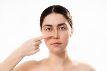 Plastic nose surgery. Portrait of young caucasian woman point her crooked bridge of the nose...