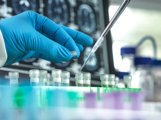 Close-up of gloved hand holding pipette in front of brain scans