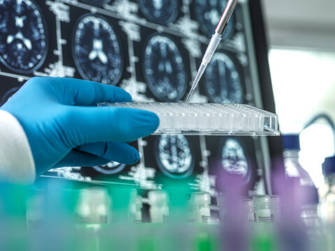 Close-up of gloved hand holding pipette and test tubs in front of brain scans