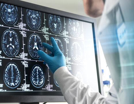 Doctor analyzing patients brain scan on screen