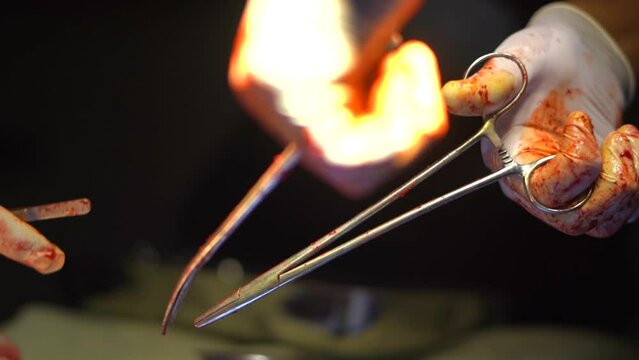 the doctor doing operation theatre ICU electric shock started attack  treatment health  close uo