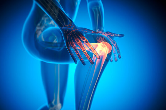 Pain in knee joint - 3D illustration