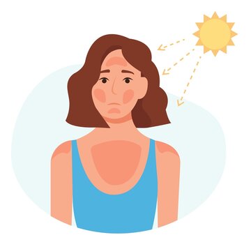 Sad woman with sunburn on his face. UV radiation damage skin in hot summer day. Health of the skin. Vector illustration