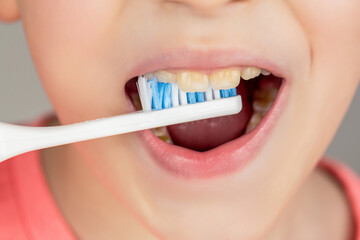 Joyful child shows toothbrushes. Little boy cleaning teeth. Dental hygiene. Happy little kid brushing her teeth. Kid boy brushing teeth. Boy toothbrush white toothpaste. Health care, dental hygiene