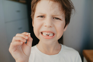 The boy holds a missing milk tooth in the palm of his hand