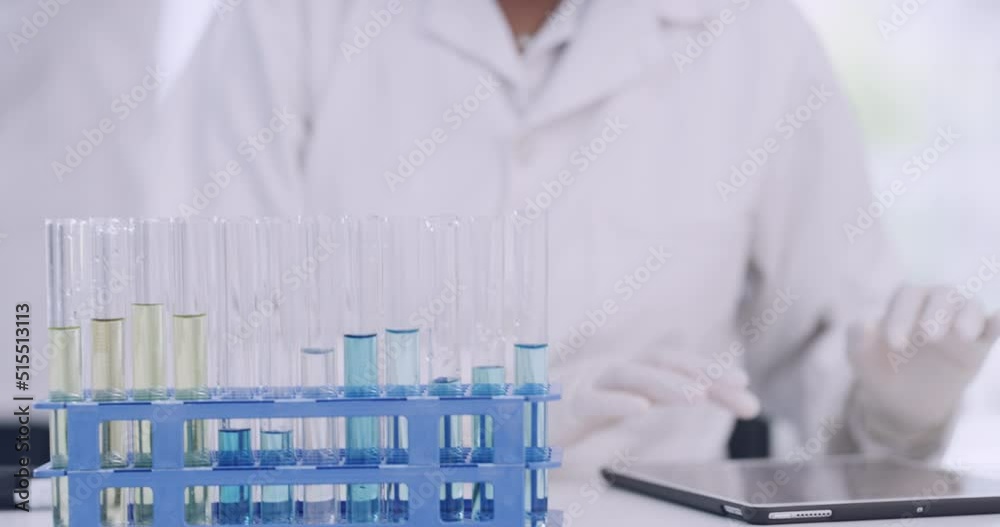 Poster scientist checking monkeypox test tube samples and recording chemical reaction results on digital ta