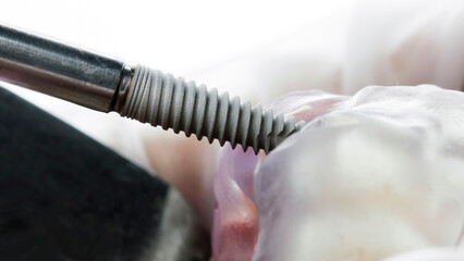 excellent moment of inserting a dental implant into a surgical template for implantation on a white background