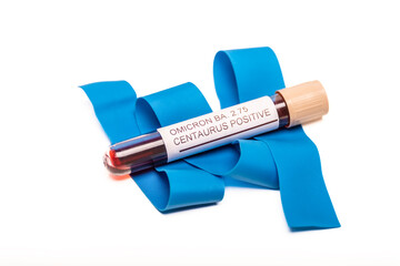 Coronavirus 2019-nCoV variant CENTAURUS BA.2.75 Blood Sample. New Epidemic Corona Virus.