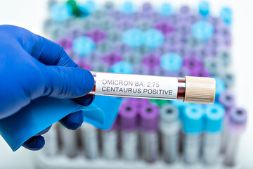 Positive blood infection sample in test tube for CENTAURUS BA 2.75 omicron covid19 coronavirus in...