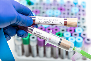 Positive blood infection sample in test tube for CENTAURUS BA 2.75 omicron covid19 coronavirus in lab. Scientist holding to check and analyze for patient in hospital. - obrazy, fototapety, plakaty
