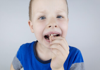 Loose baby teeth. Blond boy touches a milk tooth with his hands and shows how he moves. Stages of growing up.