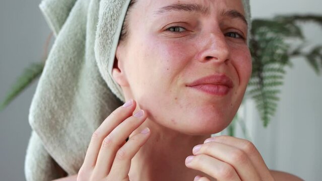 Frustrated young woman with towel on head dissatisfied with skincare product effects or skin condition, feeling stressed, looking at camera. Touching problem acne on her face in bathroom after shower
