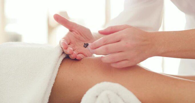 Masseuse treating a knee injury with dry needling technique. Hands of a physio working on a customers legs in a beauty spa. Tending to an injury or muscle fatigue. Rest, relaxation and recovery