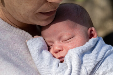 mother holding her baby with milia acne problem on face