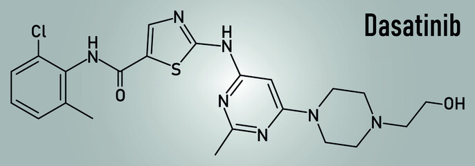 Skeletal formula of Dasatinib cancer drug molecule.