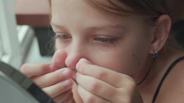 Young girl is trying to squeeze out pimple on her nose. Rash on face in adolescence.