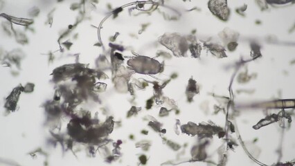 顕微鏡で拡大したハウスダストとダニ