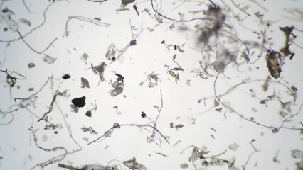顕微鏡で拡大したハウスダストとダニ